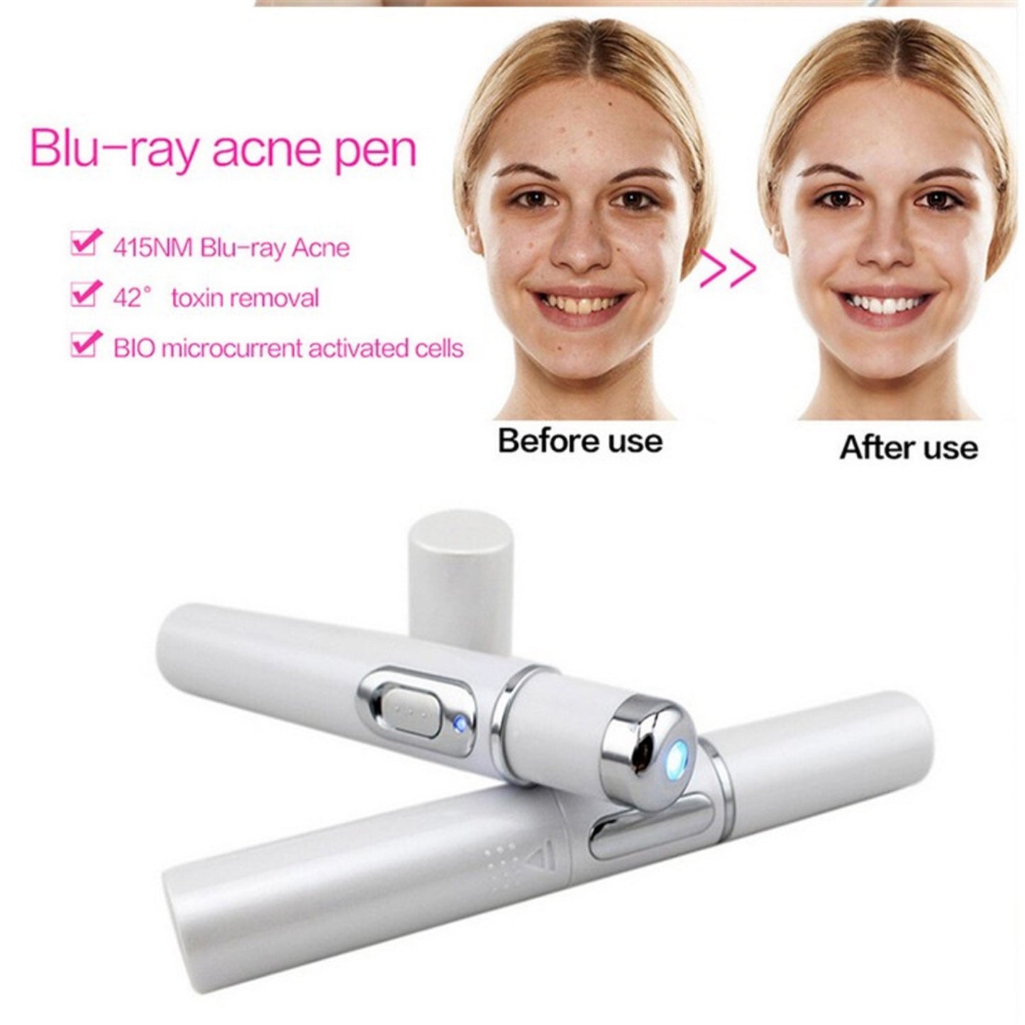 Blue Light Acne Therapy Laser Pen