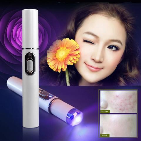 Blue Light Acne Therapy Laser Pen