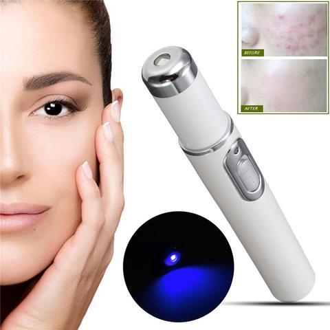 Blue Light Acne Therapy Laser Pen